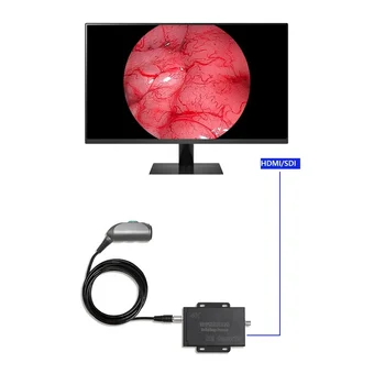 Профессиональное ЛОР-оборудование Портативная медицинская камера 4K HD для отоскопа носа